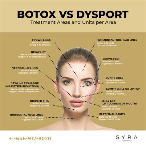 dysport|dysport vs botox which lasts longer.